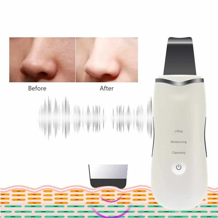 Electric Dead Skin Scrubber Peeling-جهاز تقشير كهربائي